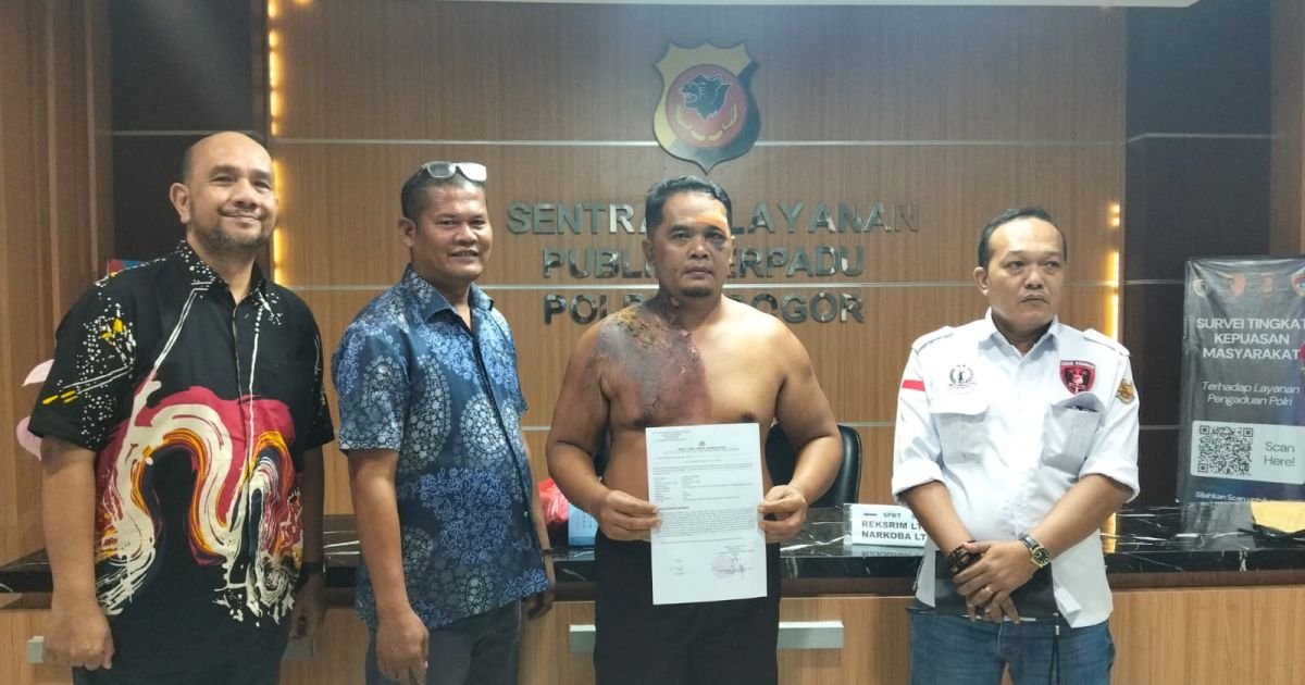 Korban Mengaku Disiram Air Panas Saat Dugaan Pengeroyokan di Cileungsi